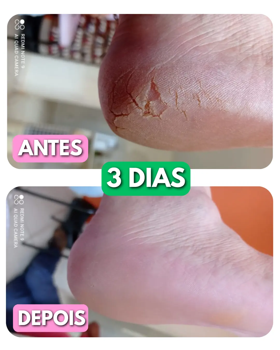 Resultado
